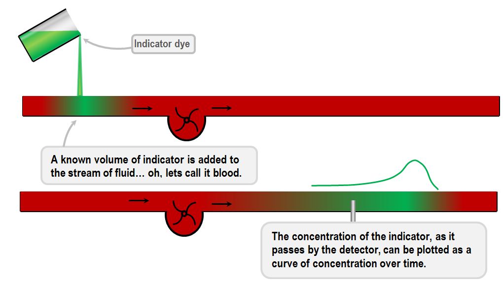 Measurement of cardiac output by indicator dilution Deranged Physiology